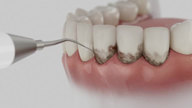 Reliable Dental contractor in Powell, OH by Smile Center Dentistry